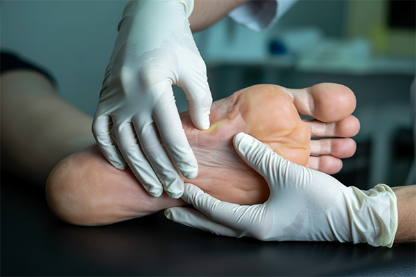 Keeping Feet Fresh: Everyday Chiropody Advice from Denton’s Experts