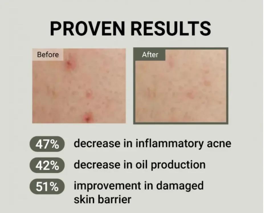 Product thumbnail 10