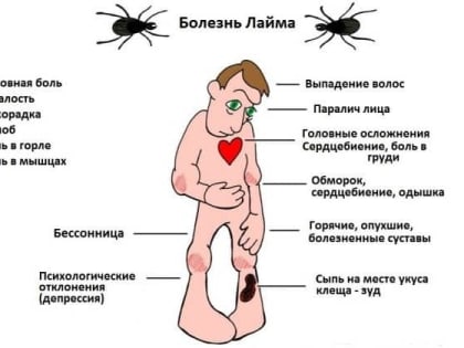 Территориальный отдел Управления Роспотребнадзора по Краснодарскому краю в Выселковском, Усть-Лабинском, Кореновском и Динском районах напоминает о мерах профилактики клещевого бор