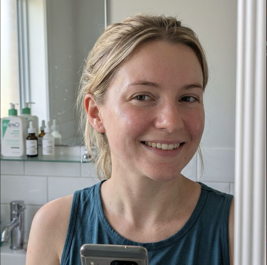 Day 14 final result — smooth glowing skin