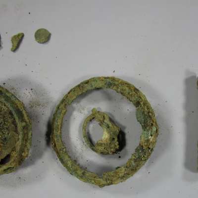 Additional artefacts- before treatment