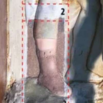 During Treatment - Details