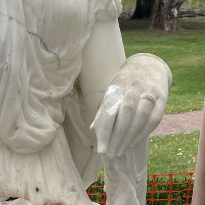 Before treatment, showing damage and loss to her left hand