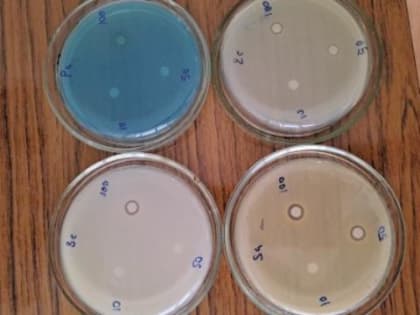 Новосибирские ученые разработали антибактериальный гель для заживления ран