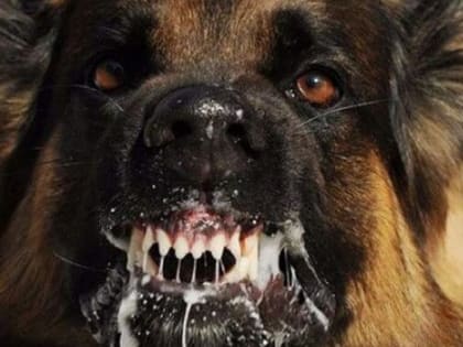 Собака напала на ребенка в Пивоварихе