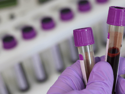 14 и 15 марта в Иркутске проводят бесплатное экспресс-тестирование на ВИЧ