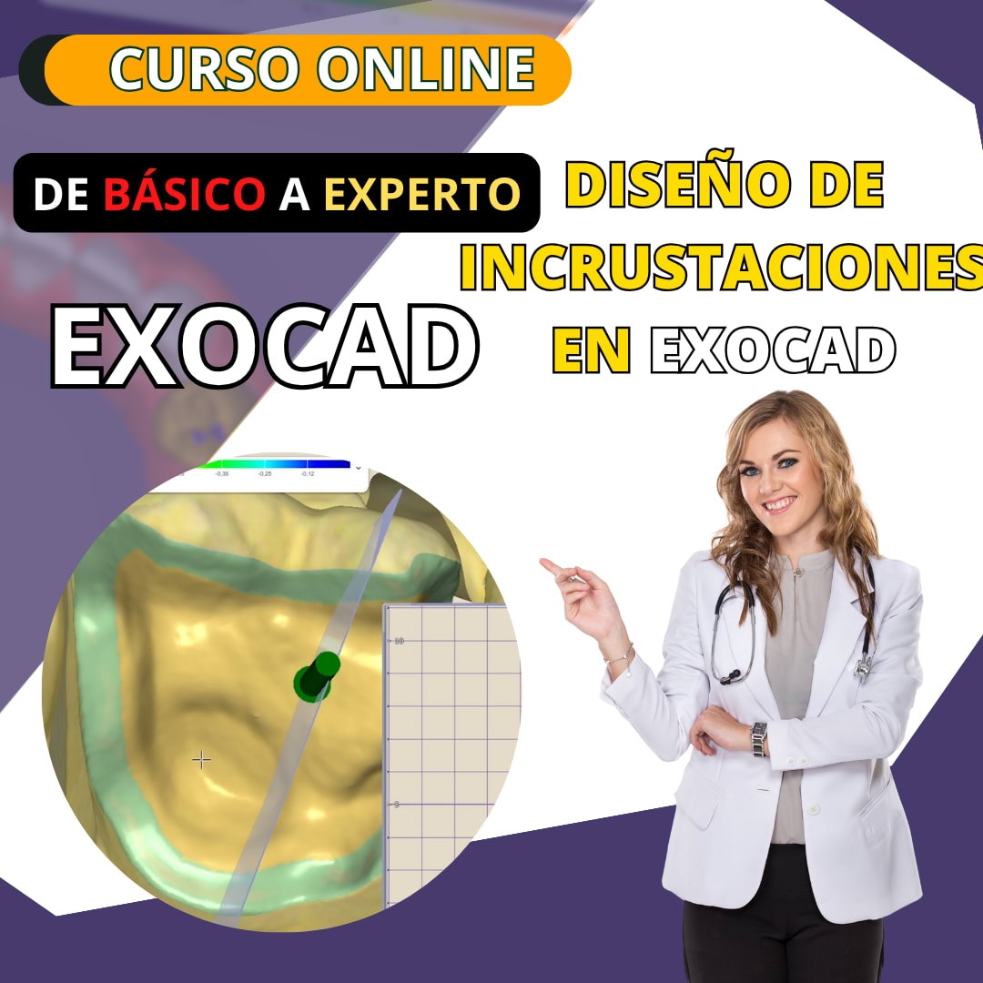 Diseño de Incrustaciones en EXOCAD