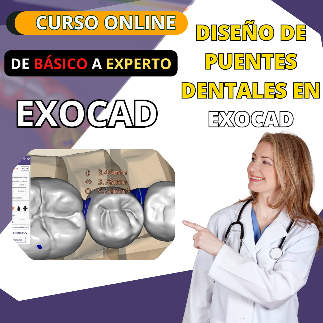 Diseño de Puentes Dentales en EXOCAD