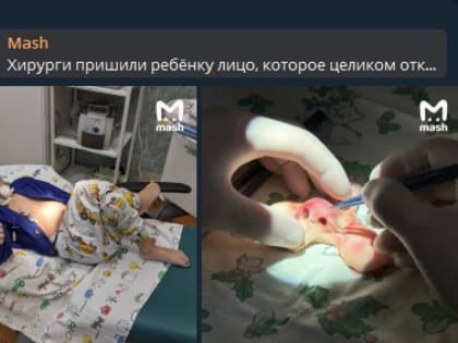 Уникальную для мировой медицины операцию сделали хирурги в Краснодаре