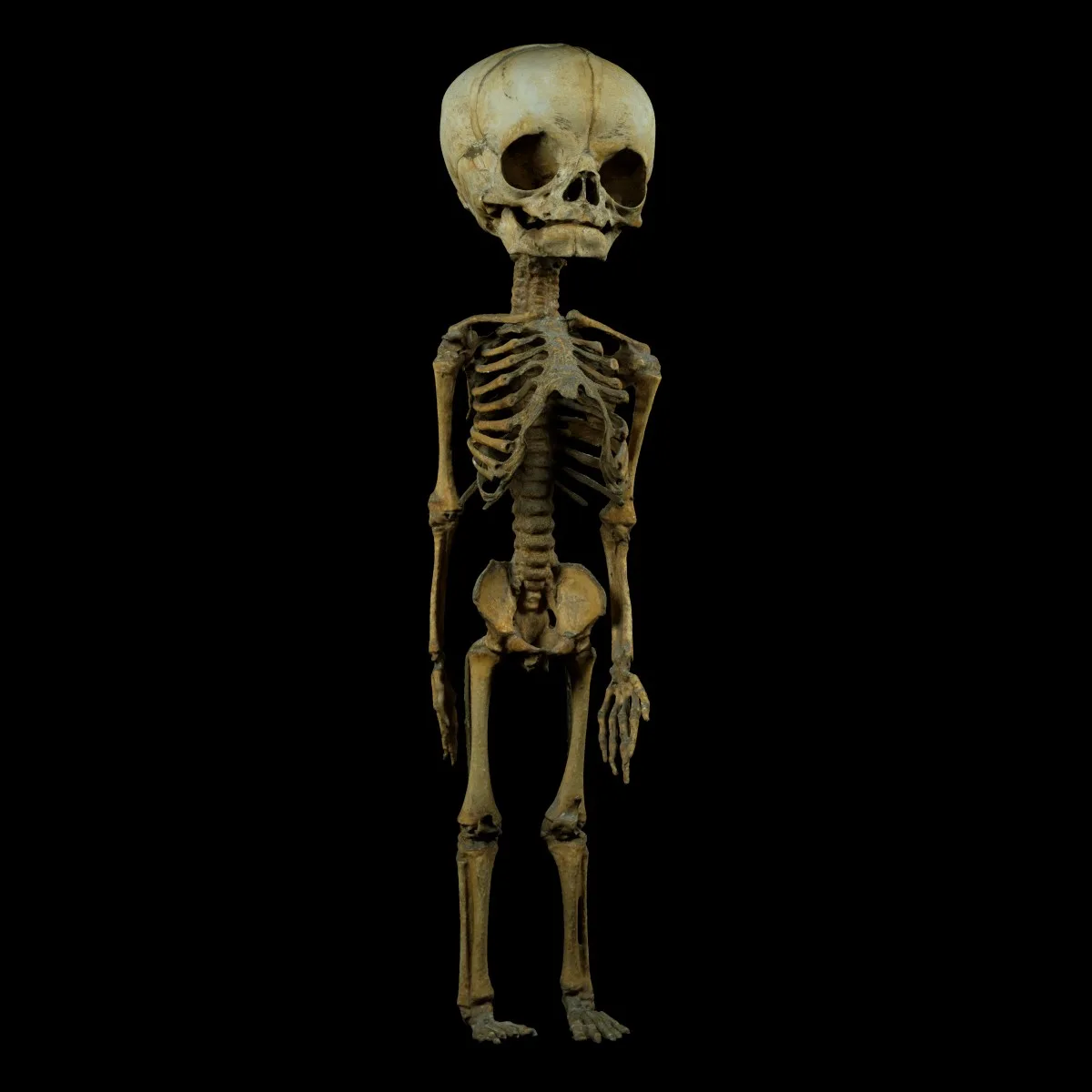 Unborn Human Baby Foetus Skeleton