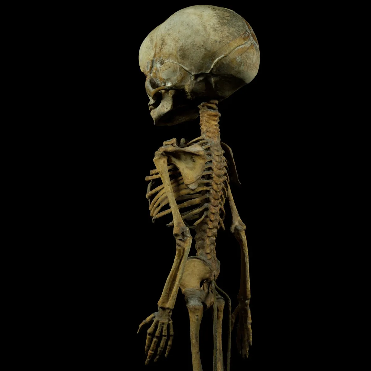 Unborn Human Baby Foetus Skeleton