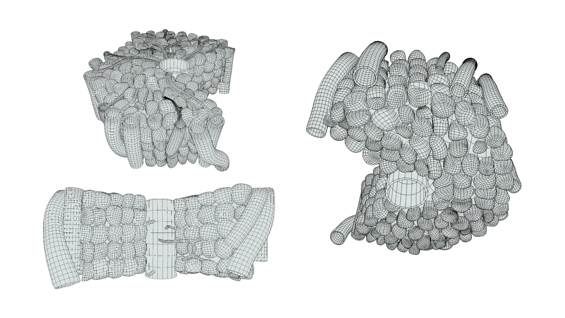 Hepatic Lobule Anatomy