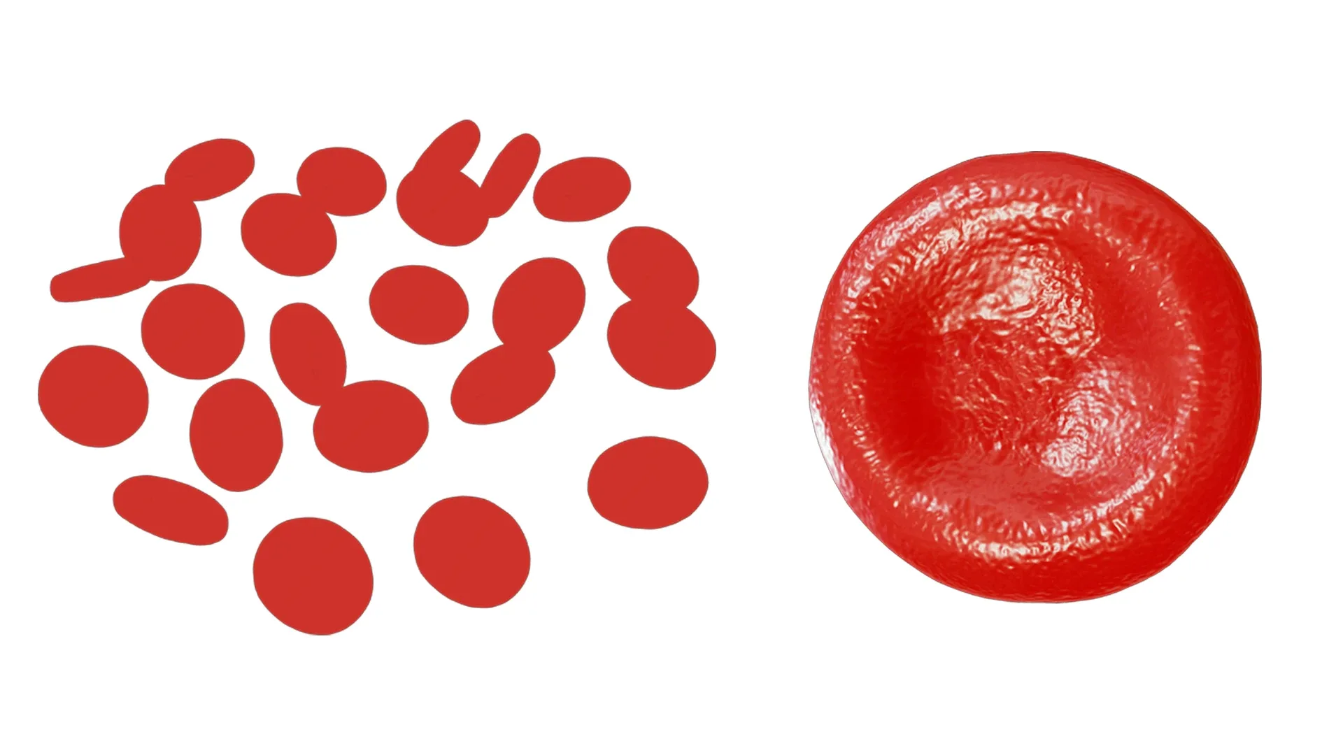 Normal Blood Cells vs Anemia