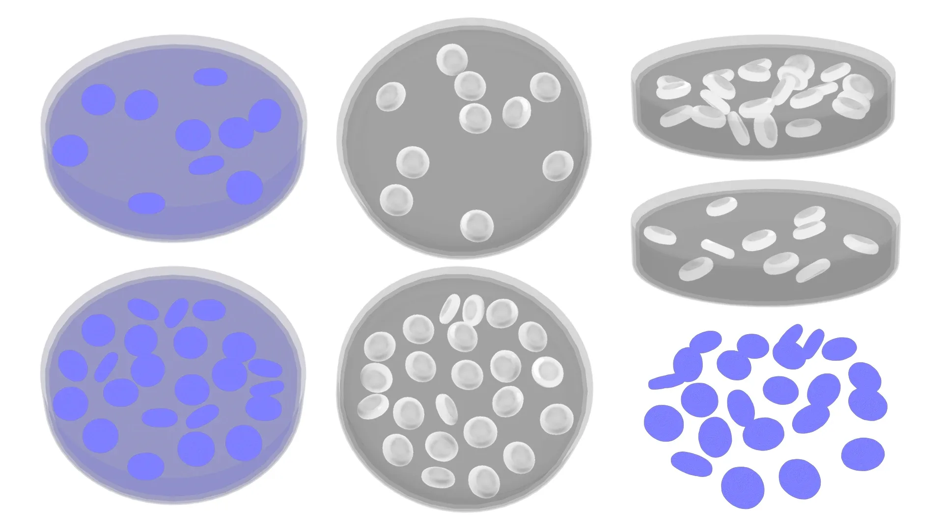 Normal Blood Cells vs Anemia