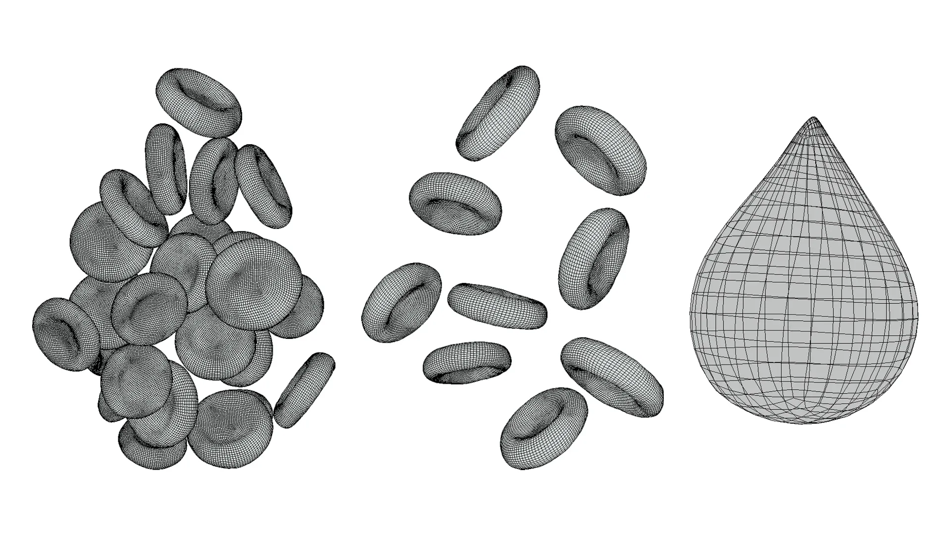 Normal Blood Cells vs Anemia