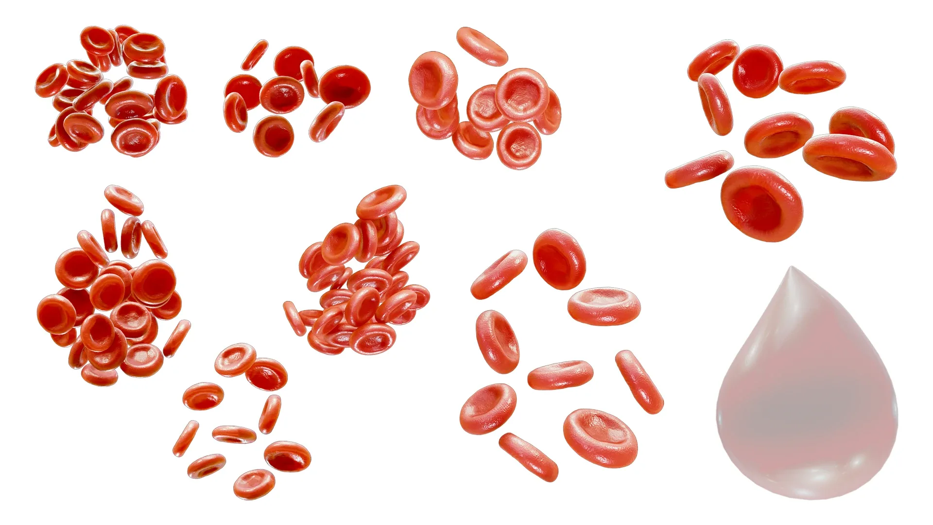Normal Blood Cells vs Anemia