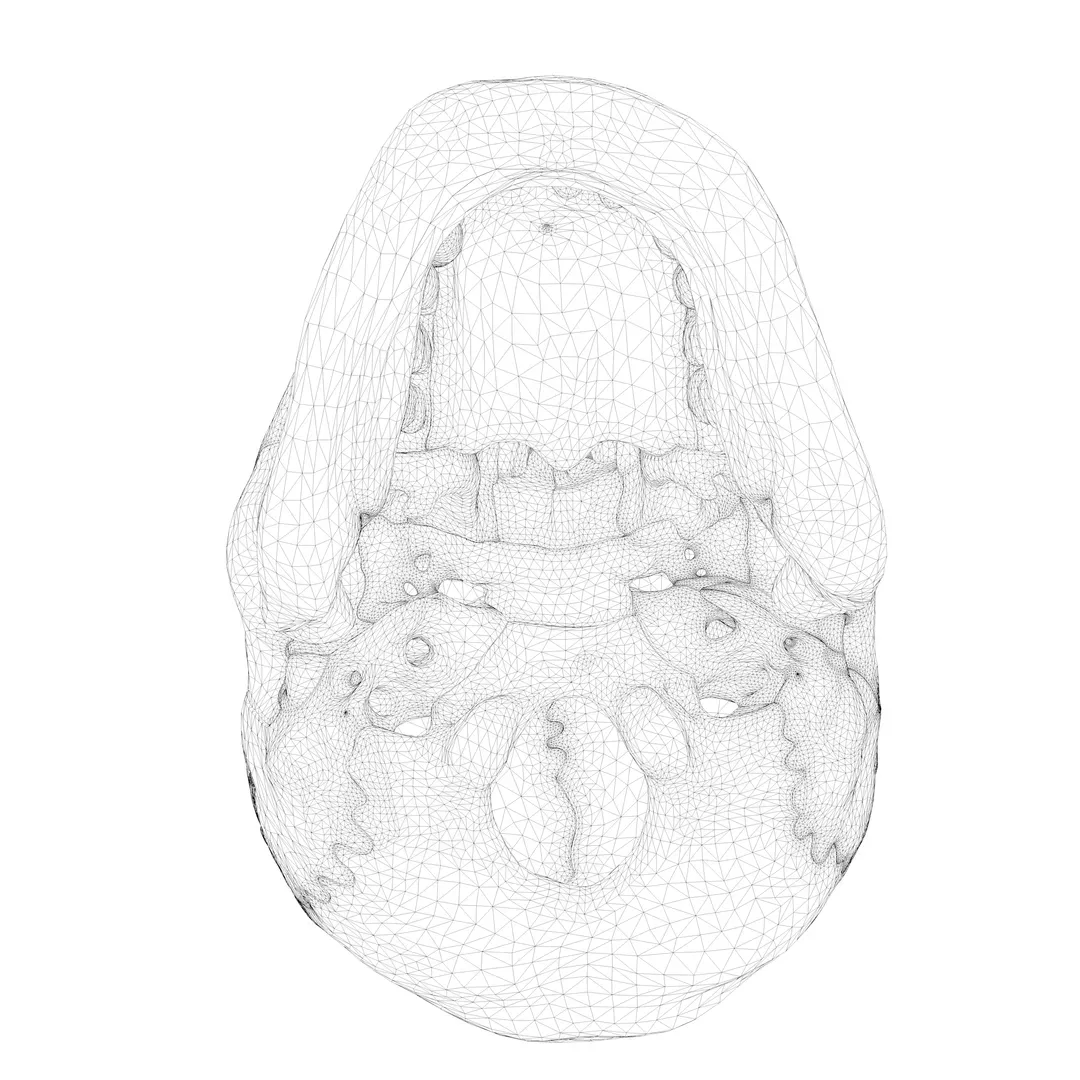 Anatomical atlas of the human skull