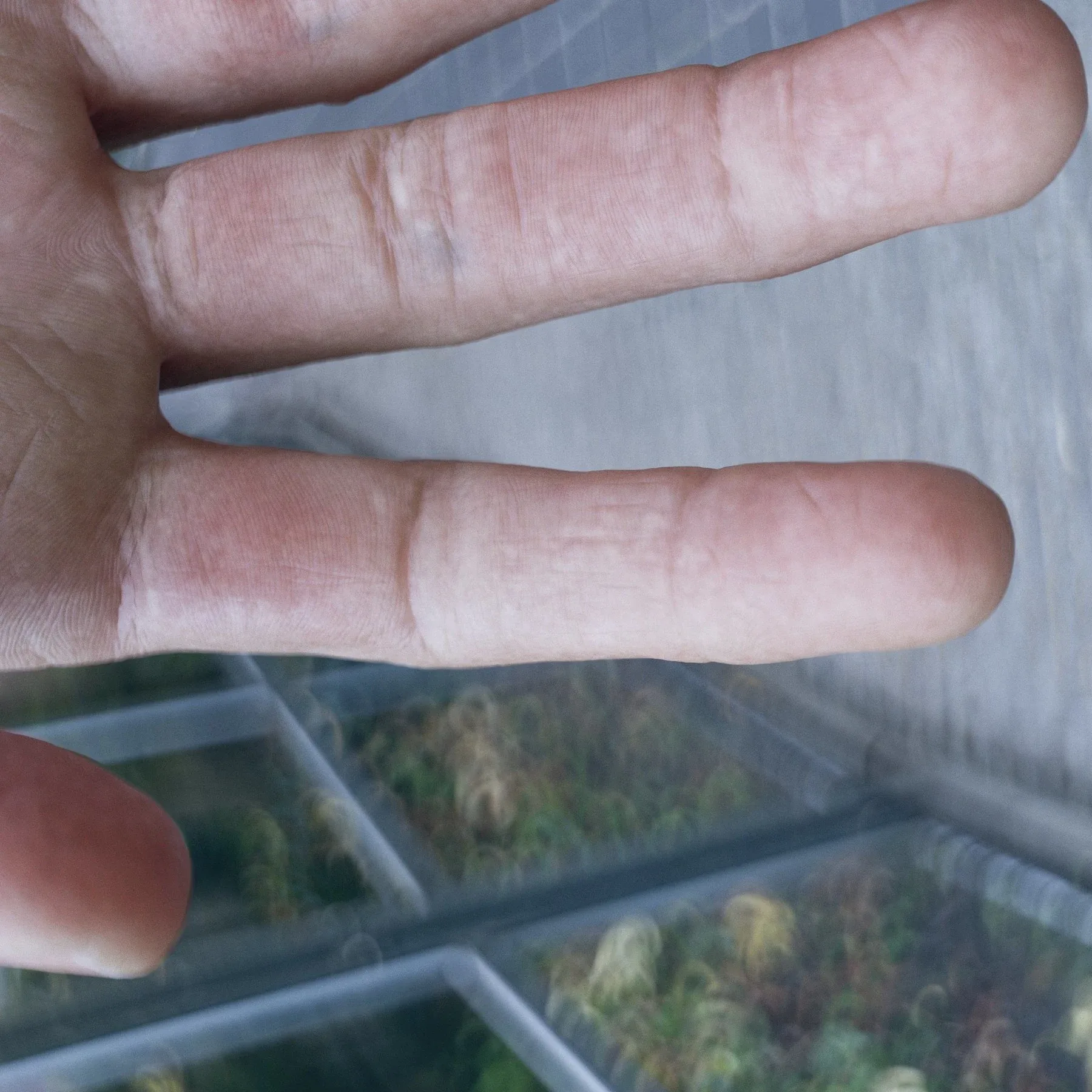 High Resolution Human Arm