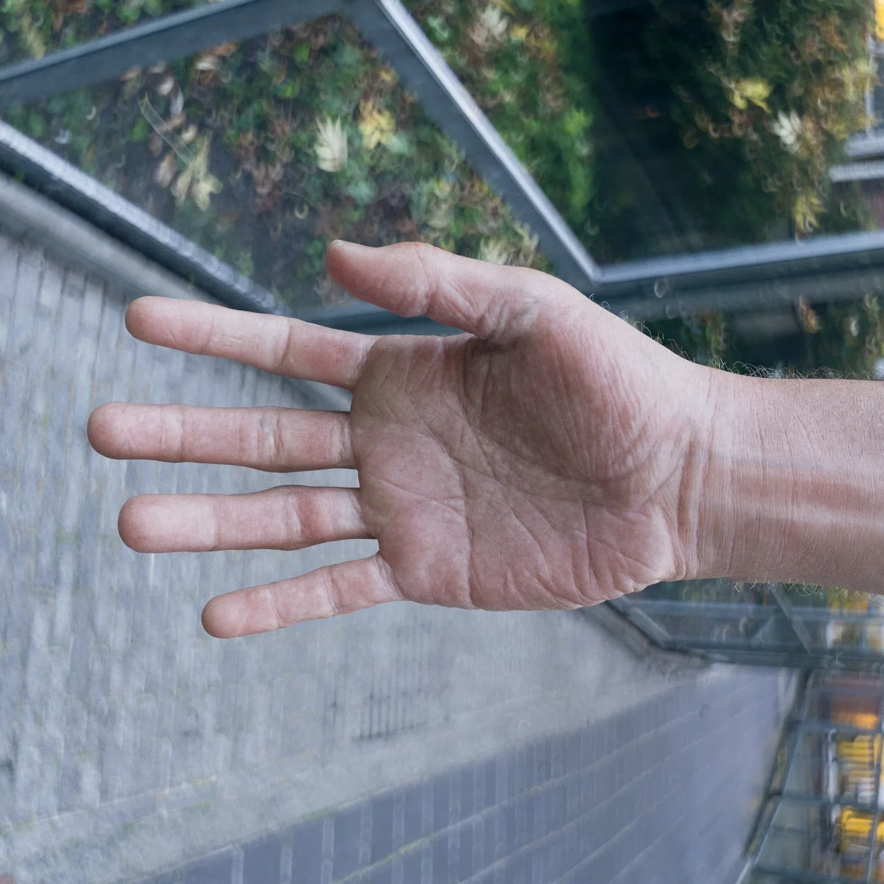 High Resolution Human Arm