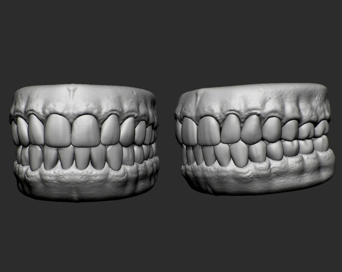 CRTM Starter Teeth Set