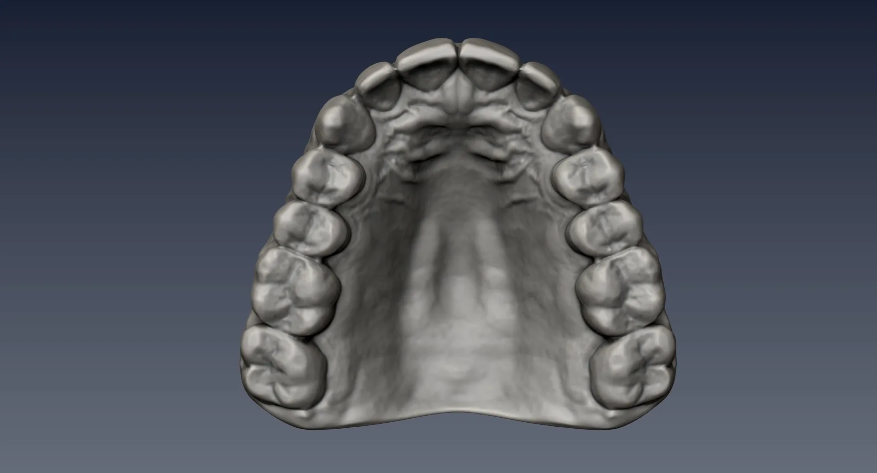 Realistic Teeth Zbrush File from Scan Data