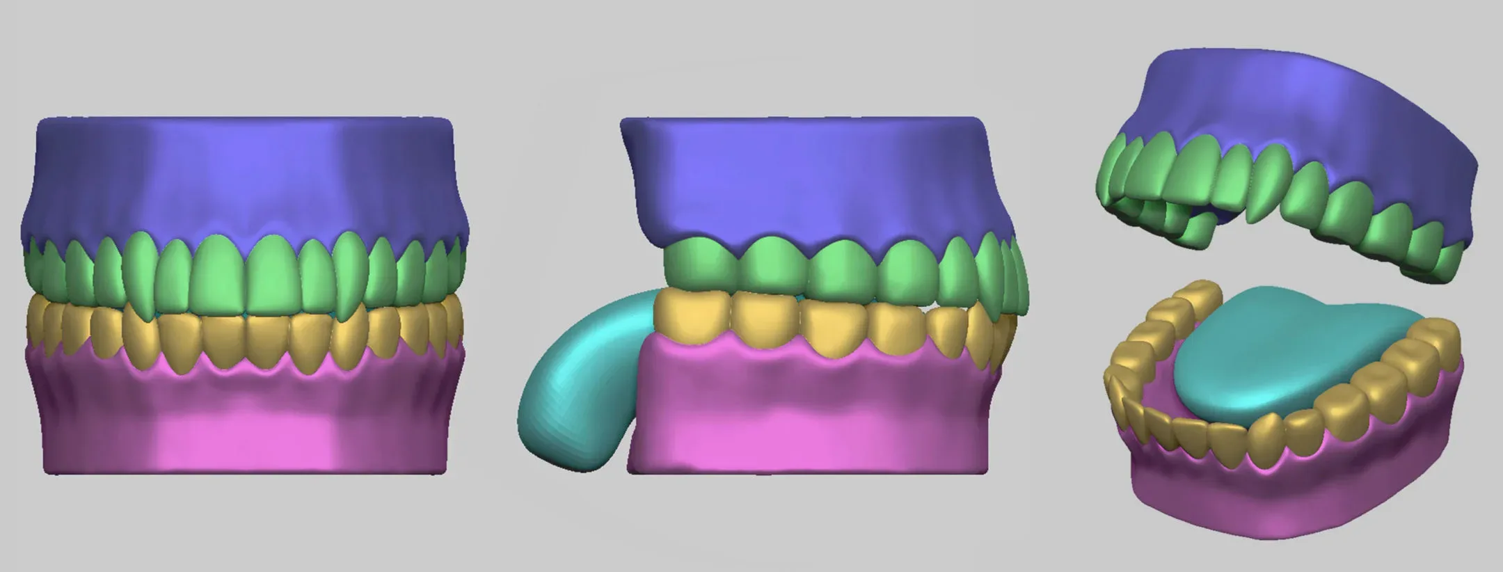 Jaw Basemesh + Lowpoly with UV Map