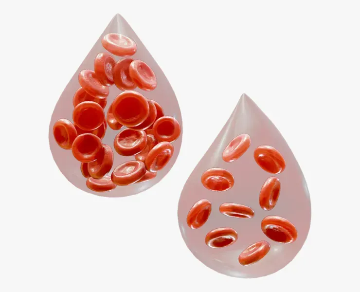 Normal Blood Cells vs Anemia