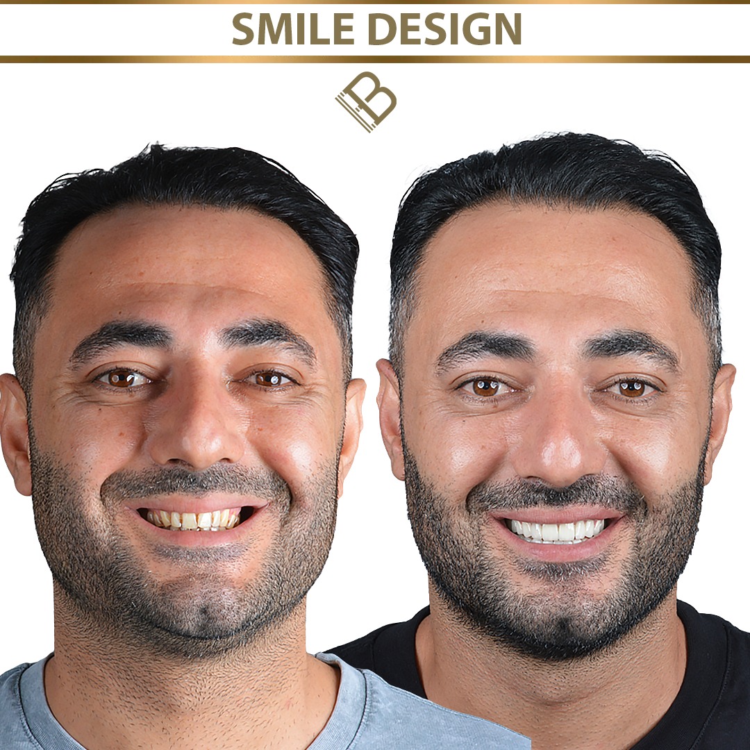 Diseño de Sonrisa de Alta Gama background