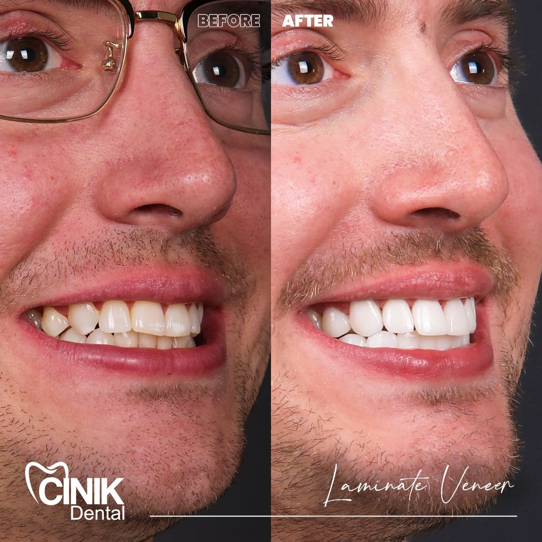 Tratamientos Dentales Completos background