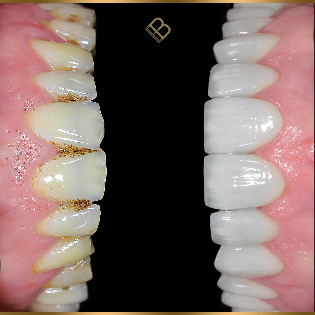 Tratamientos Dentales