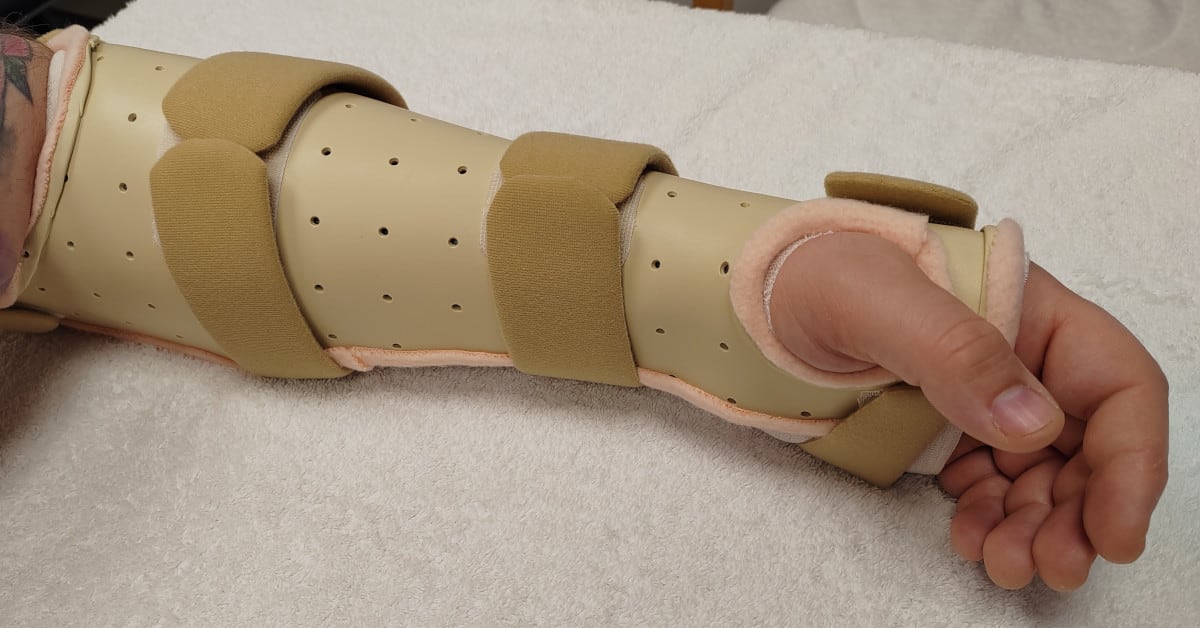 Caring for Your Hand and Wrist Splint | The Hand Therapist