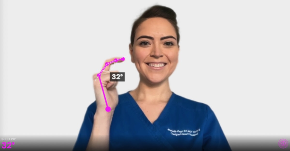 Ms Michelle Razo demonstrating AR finger goniometry in a hand therapy session