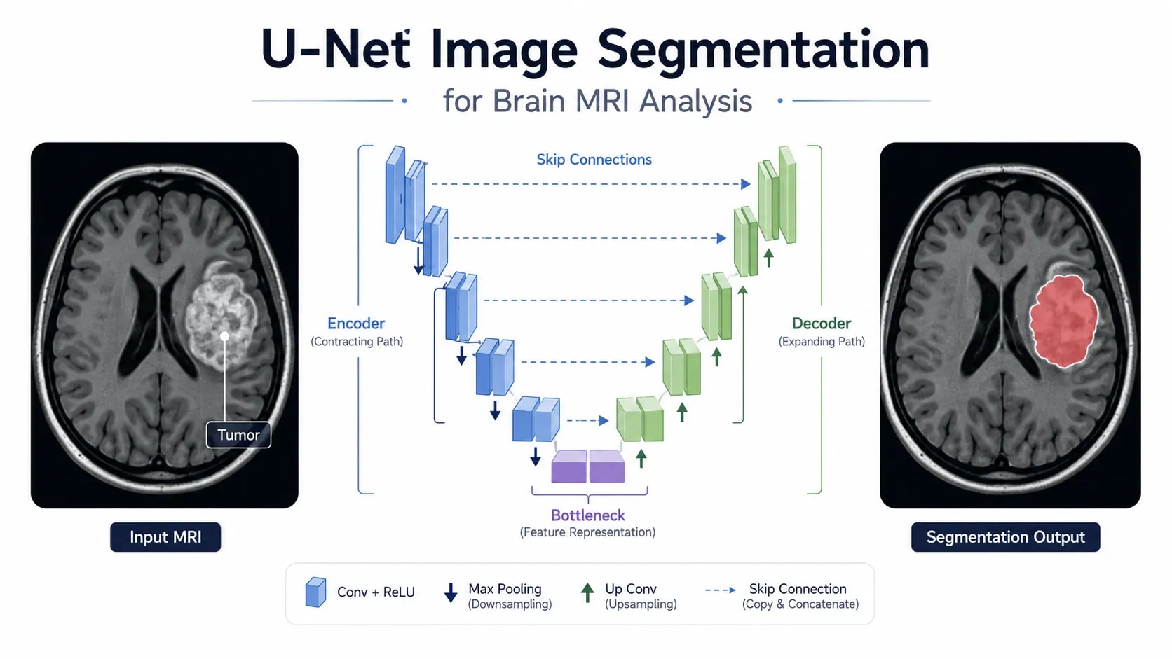 U-Net Image Segmentation Explained