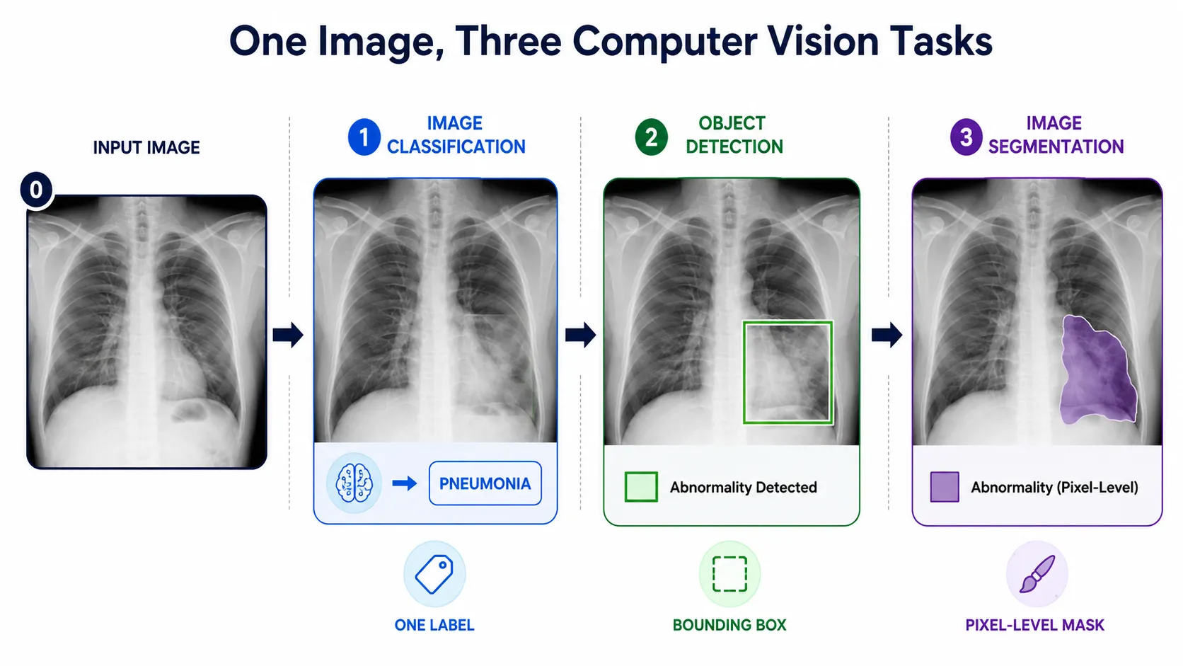 image segmentation explained