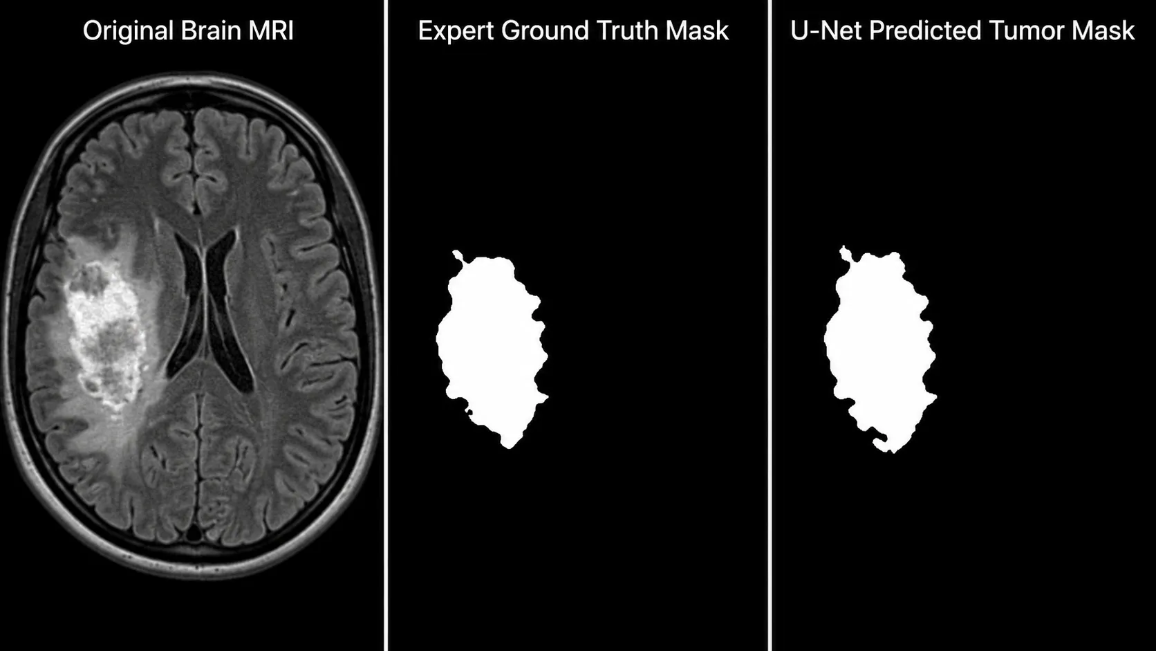 mri tumor mask comparison