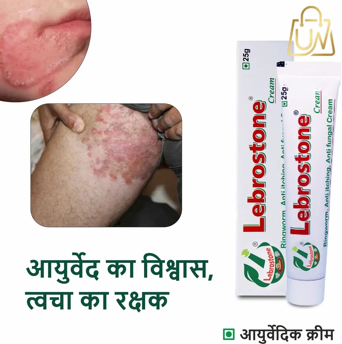 Lebrostone Ayurvedic Skin Ointment (25g)