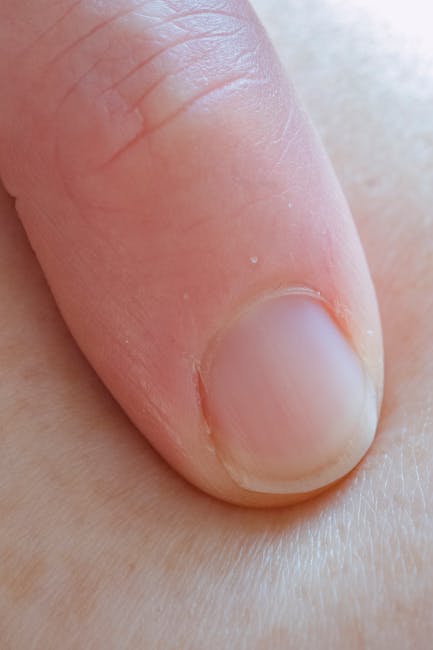 nail-fungs_3