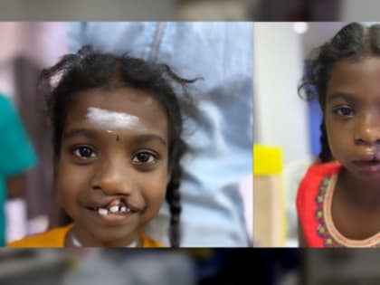 Педиатр из Владимира помогает индийским детям улыбаться