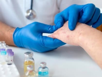 Во Владимире удалось локализовать очаги кори в гимназии и детском саду