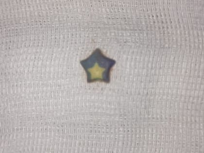 Владимирские врачи спасли двухлетнего малыша, проглотившего пластиковое украшение