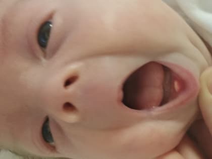 Новорожденный с зубами удивил врачей во Владимире