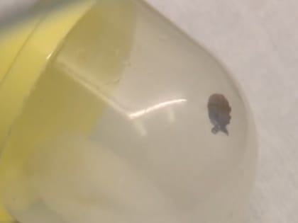 За неделю во Владимирской области от клещей пострадали 76 человек, среди них 13 детей