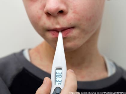 Среди владимирцев растет заболеваемость корью, которую, казалось бы, победили