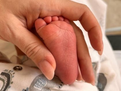 В Областном перинатальном центре владимирскими врачами были проведены две уникальные операции