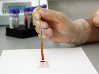 Самый надежный способ снизить уровень вредного холестерина в крови