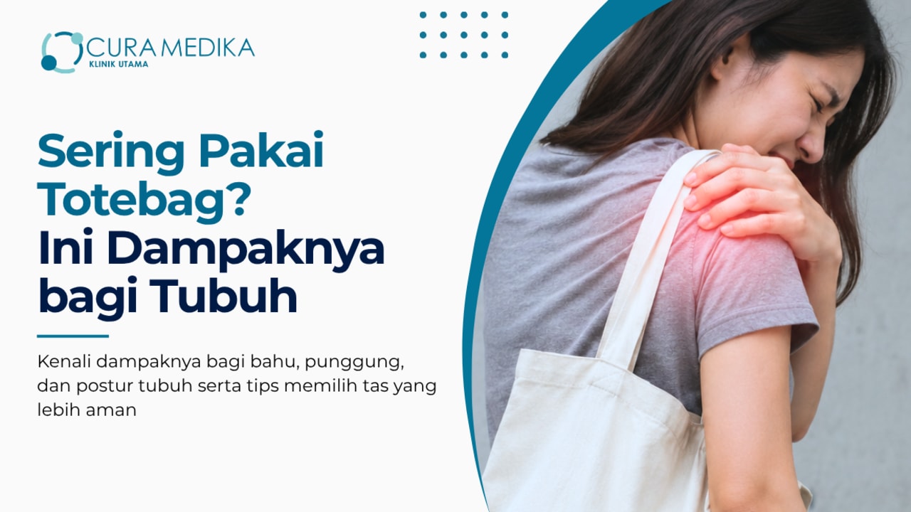 Sering Pakai Totebag? Ini Dampaknya bagi Bahu, Punggung, dan Postur Tubuh