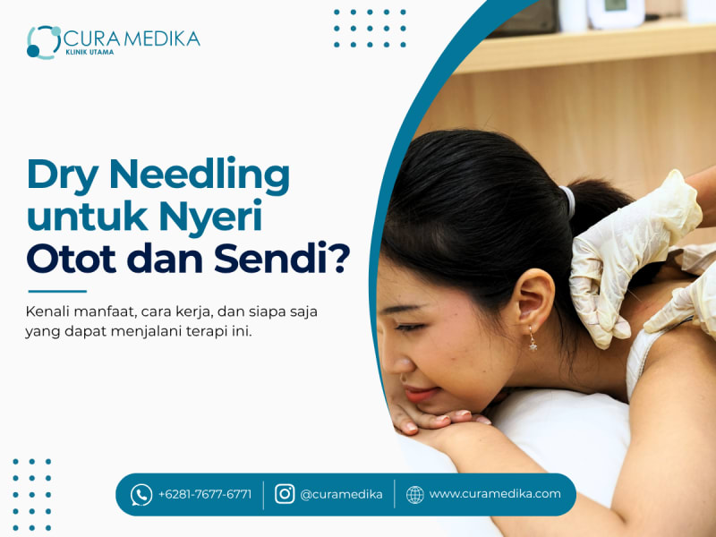 Dry Needling untuk Nyeri Otot dan Sendi? Kenali Manfaat, Cara Kerja, dan Siapa yang Cocok Menjalaninya