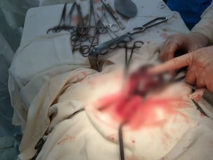 В Ишимбае прооперировали бойца СВО