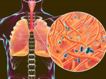 Как уберечься от коклюша