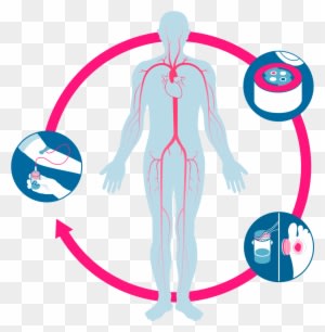 Treatment Evidence Technology - Wound Healing - Transparent PNG Free Download